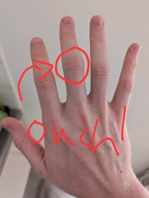 my middle finger hurting