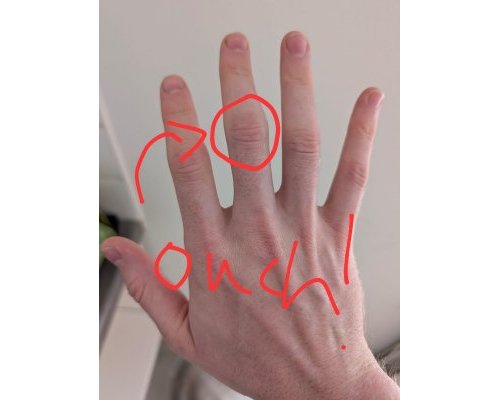 I healed RSI using only my mind